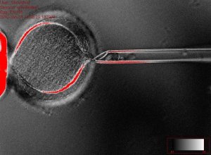 Клонирование стволовых клеток началось